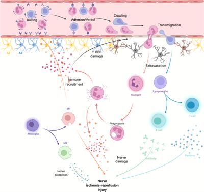 Systemic immune responses after ischemic stroke: From  - Frontiers